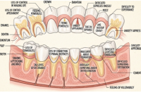 Kode Alam Mimpi Gigi Copot